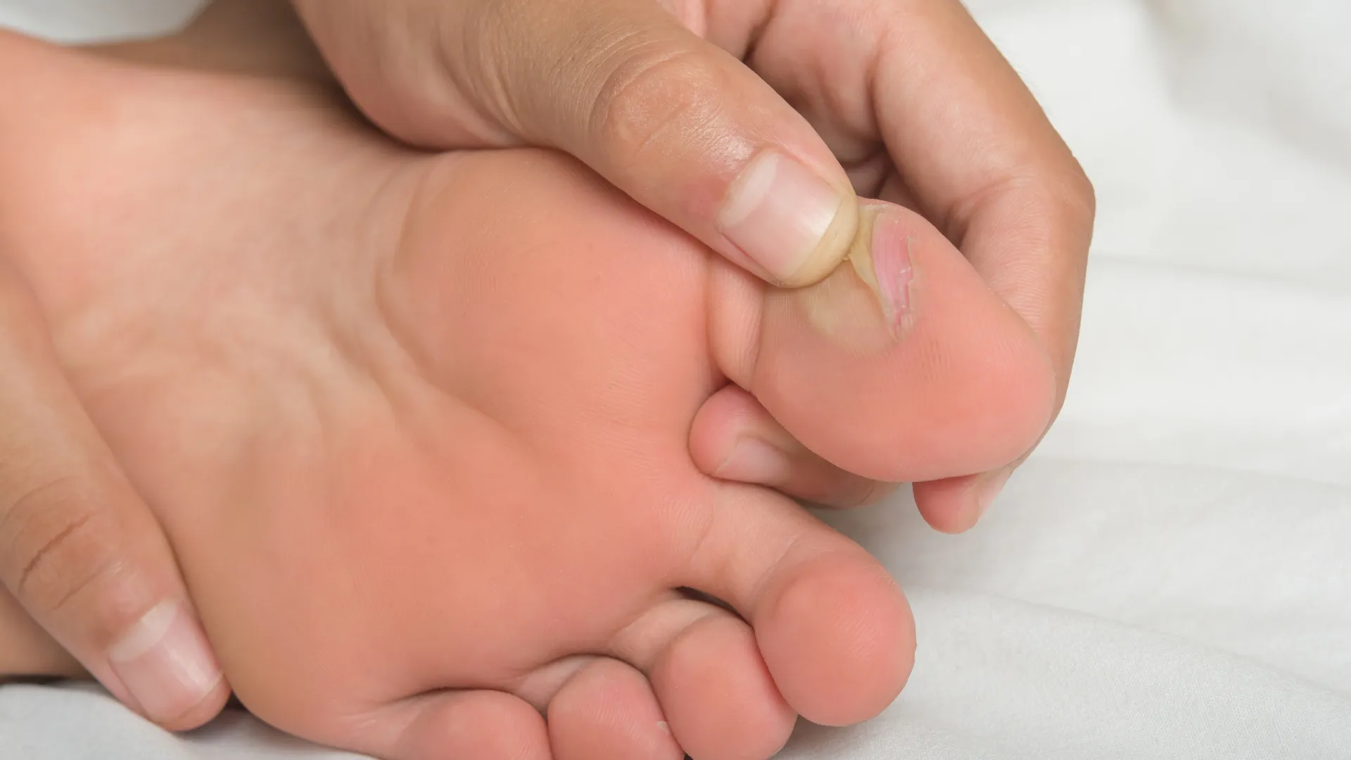 Ampollas en los pies